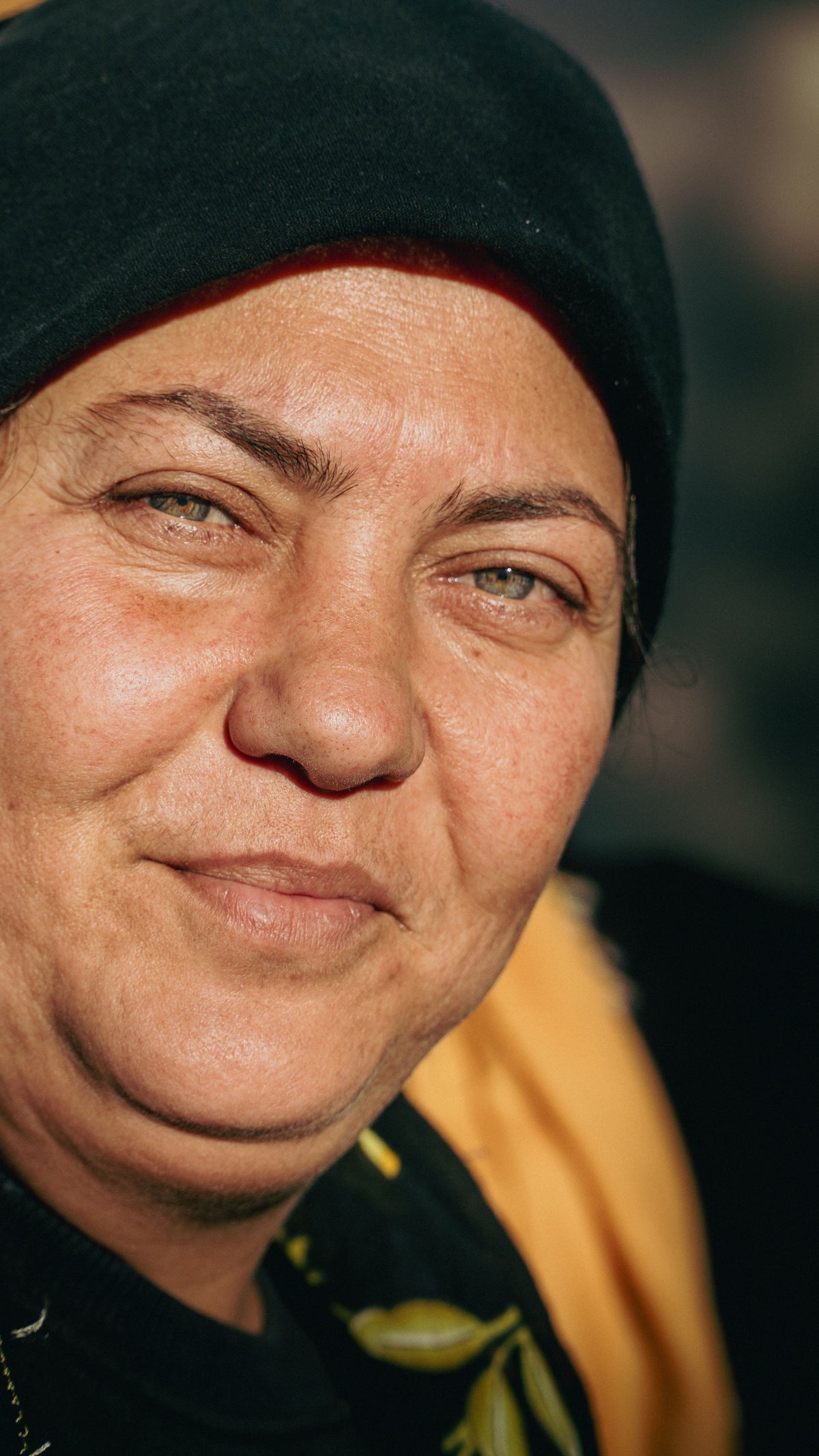 Close-up of a smiling woman in a black headscarf with uneven pigmentation on olive skin