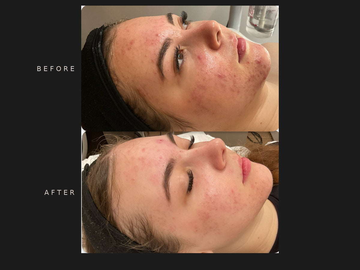 Before and after: Millie, side view, October to January