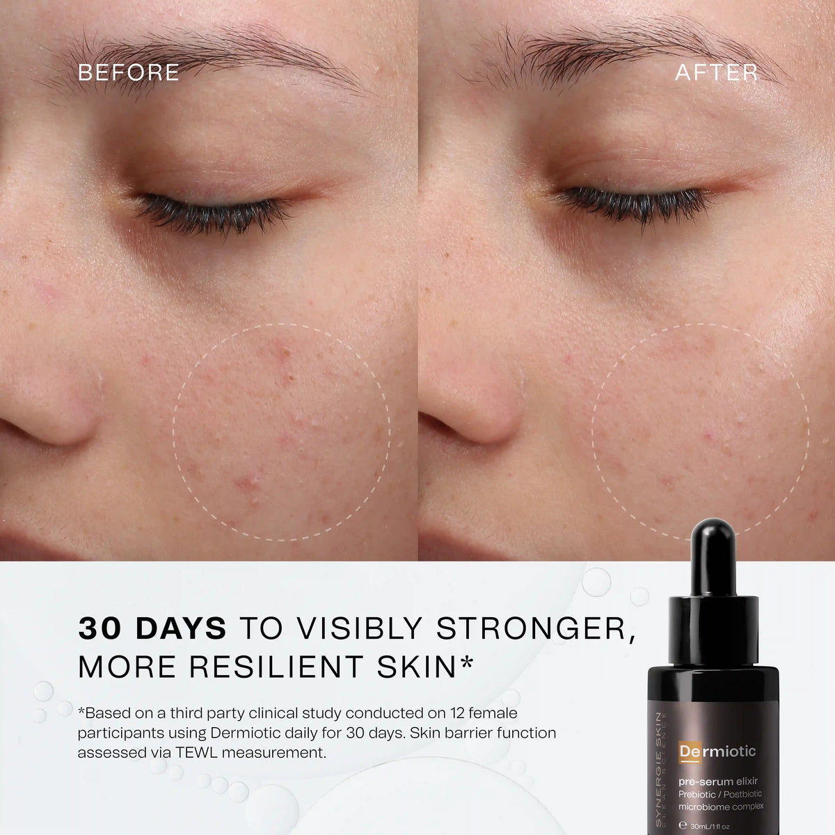 Dermiotic