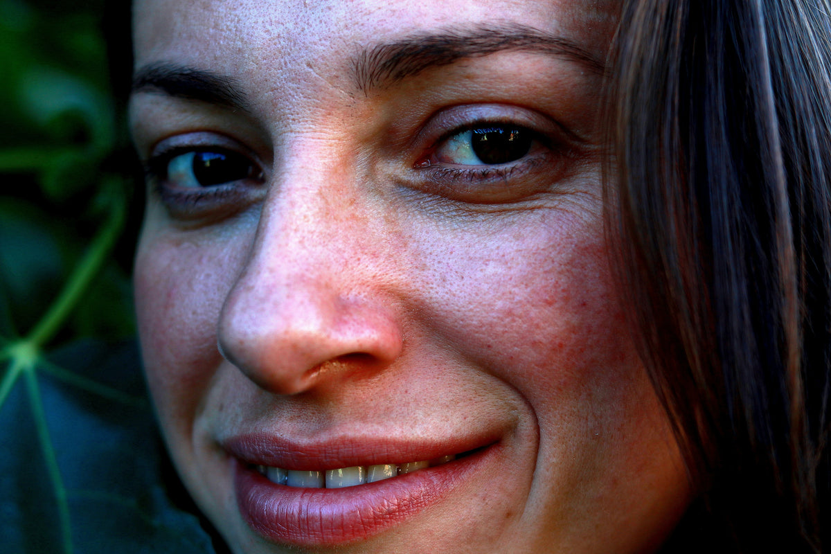 Close-up of a smiling woman with freckles and sun spots across her cheeks