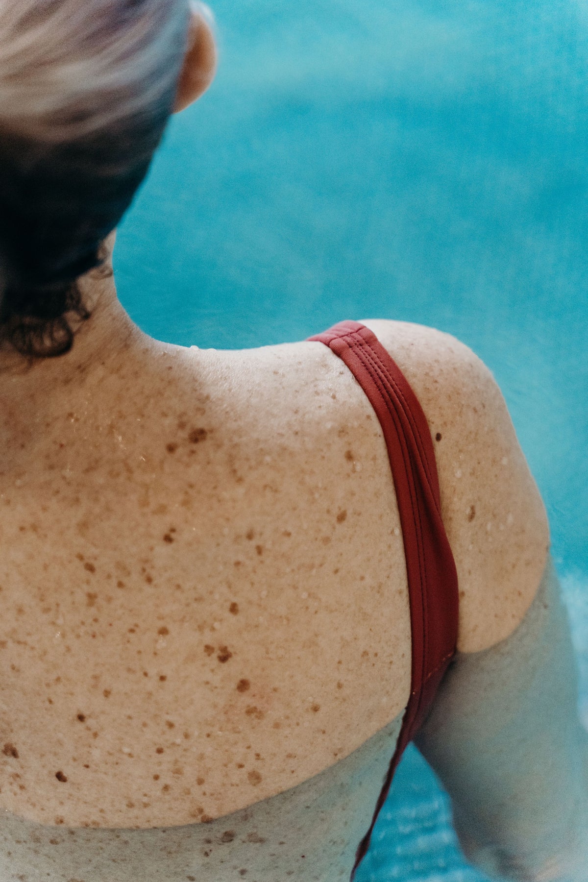 Woman's upper back and shoulder with moles and freckles beside a pool