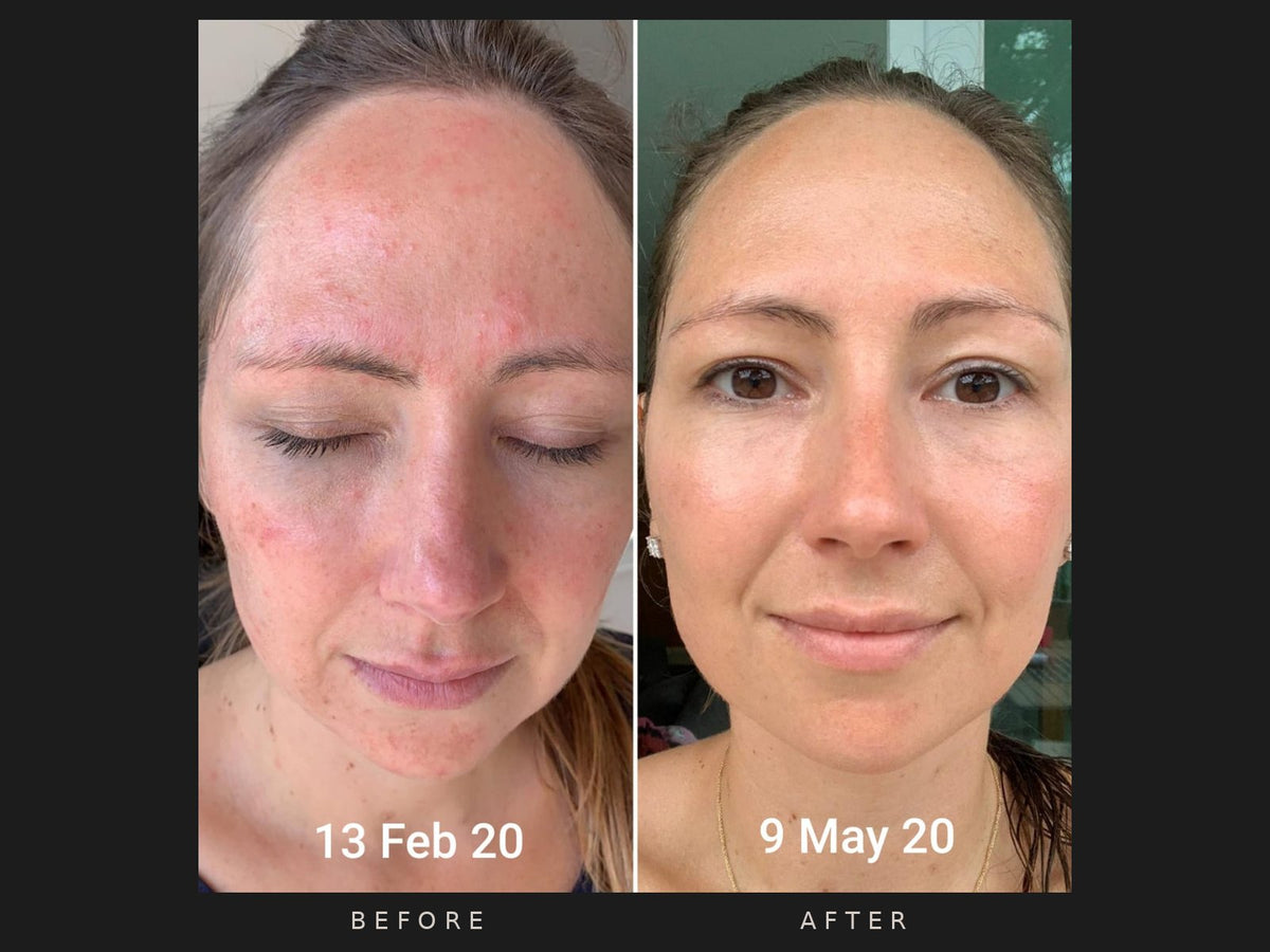 Before and after: Els, 13 February to 9 May 2020