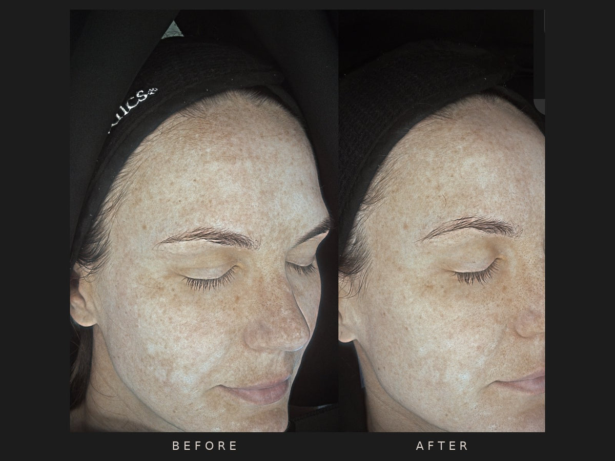 Before and after: Julianna, four months apart